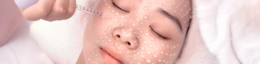Bank Your Collagen Like a Pro: Why This Microneedling Treatment Has Singapore Talking