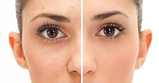 The Anti-Aging Code: Skin Management So Good, You Might Forget Your Birthday